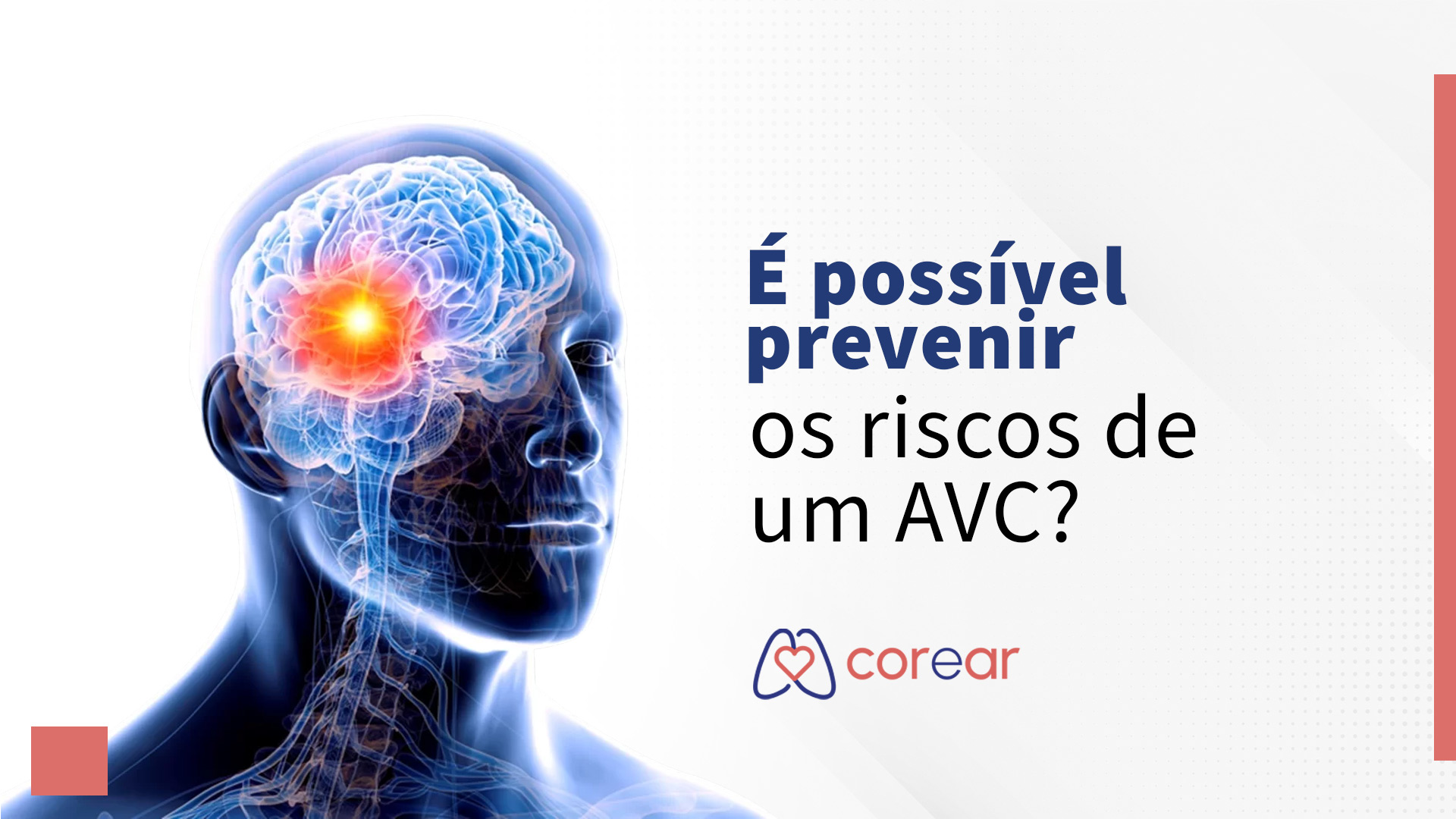É possível prevenir os riscos de um AVC?